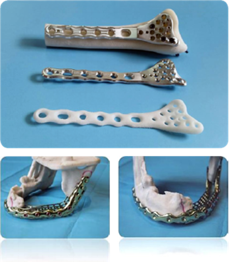 Blueprinter 3DӡCoɹǰOӋC