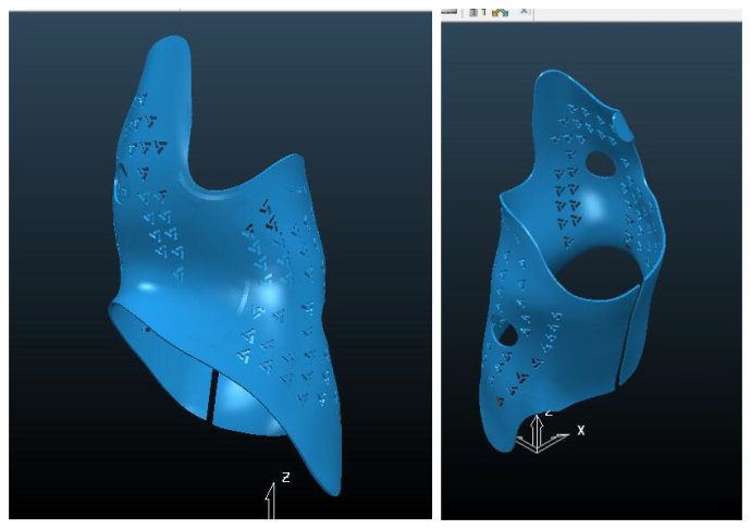 世界首例可穿戴的3D打印脊柱側彎支具在我工作室誕生! 世界首例可穿戴的3D打印脊柱側彎支具在我工作室誕生!