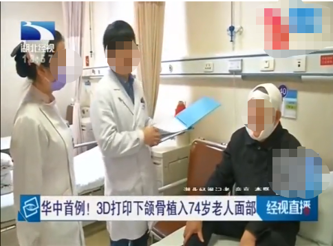 華中首例!3D打印鈦合金下頜骨植入74歲老人面部 華中首例!3D打印鈦合金下頜骨植入74歲老人面部